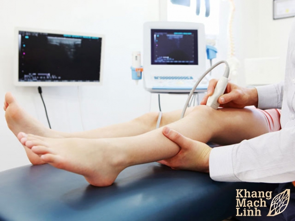 Siêu âm suy giãn tĩnh mạch chi dưới: Những điều cần biết