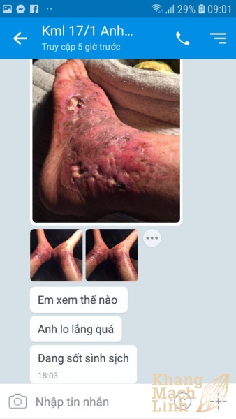 “KHANG MẠCH LINH LÀ ÂN NHÂN CỦA TÔI”