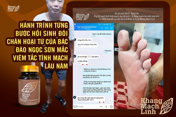 HÀNH TRÌNH TỪNG BƯỚC HỒI SINH ĐÔI CHÂN HOẠI TỬ CỦA BÁC ĐÀO NGỌC SƠN MẮC VIÊM TẮC TĨNH MẠCH LÂU NĂM