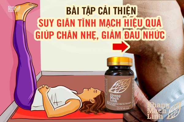 Bài tập cải thiện suy giãn tĩnh mạch hiệu quả giúp chân nhẹ, giảm đau nhức